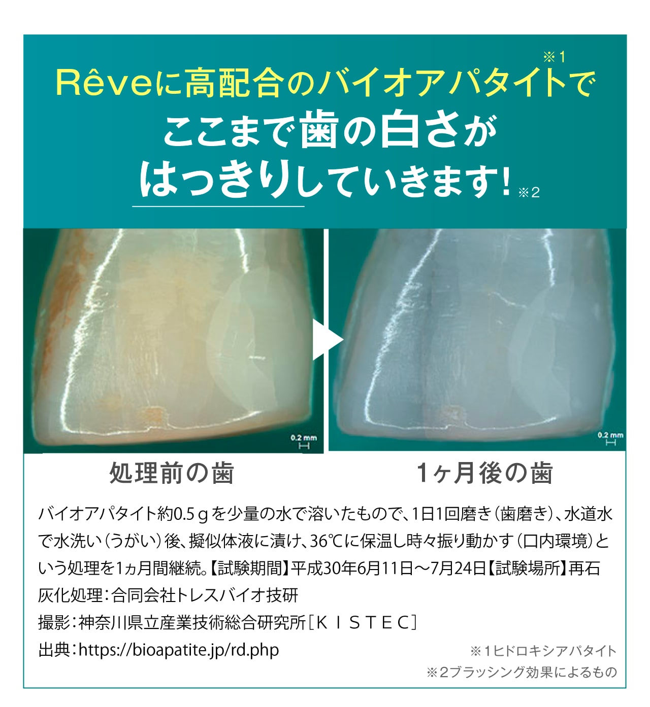 REVE